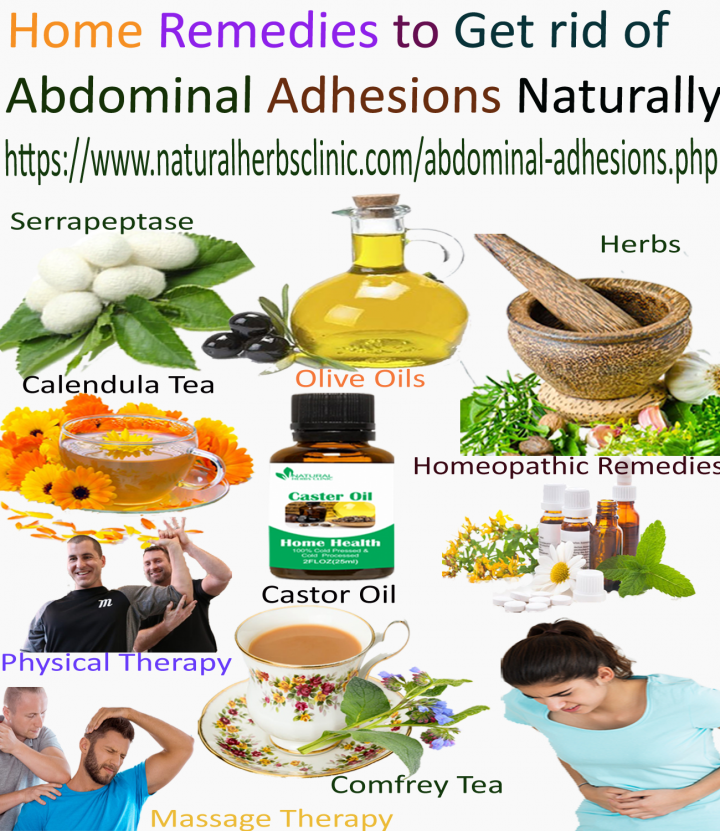 Natural Remedies for Abdominal Adhesions
